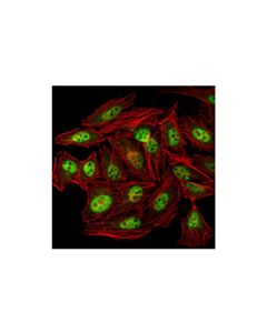 Cell Signaling PRMT4/CARM1 (3H2) Mouse mAb 20 uL