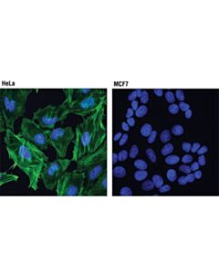 Cell Signaling Caldesmon-1 (D5c8d) Xp Rabbit mAb