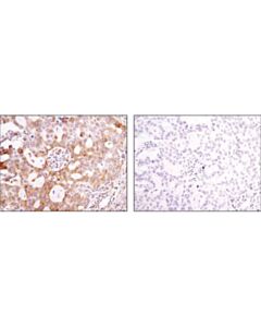 Cell Signaling Eml4 (D5v6m) Rabbit mAb