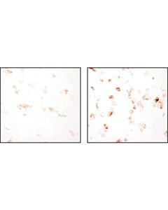 Cell Signaling Phospho-Vegf Receptor 2 Antibody Sampler Kit
