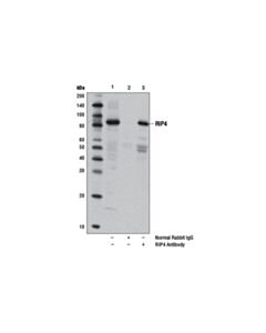 Cell Signaling Rip4 Antibody