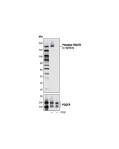 Cell Signaling Pdgf Receptor Activation Antibody Sampler Kit