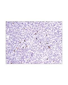 Cell Signaling Foxp3 (D6o8r) Rabbit mAb
