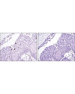Cell Signaling Signalstain  Apoptosis (Cleaved Caspase-3) Ihc Detection Kit