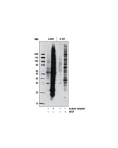 Cell Signaling Phospho-Tyrosine (P-Tyr-1000) Multimab Rabbit mAb Mix (Hrp Conjugate)