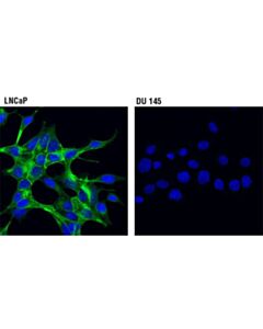 Cell Signaling Prostate Specific Membrane Antigen (D4s1f) Rabbit mAb