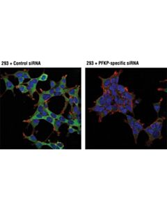 Cell Signaling Pfkp (D2e5) Rabbit mAb