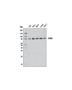 Cell Signaling PFKP (D2E5) Rabbit mAb 20 uL
