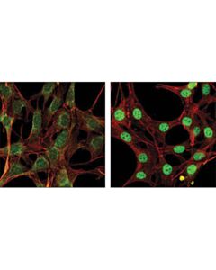 Cell Signaling Smad2/3 Antibody Sampler Kit