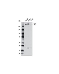 Cell Signaling Taf1 (D6j8b) Rabbit mAb