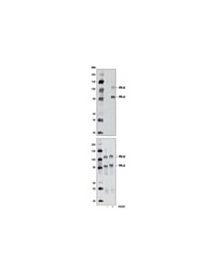 Cell Signaling Phospho-Progesterone Receptor (Ser345) Antibody