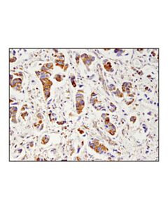 Cell Signaling Glutamate Dehydrogenase 1/2 (D9f7p) Rabbit mAb