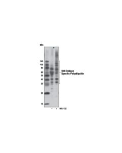 Cell Signaling K48-Linkage Specific Polyubiquitin (D9d5) Rabbit mAb (Hrp Conjugate)