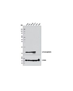 Cell Signaling beta2-microglobulin (D8P1H) Rabbit mAb
