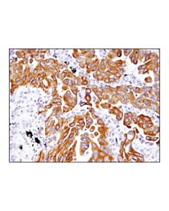Cell Signaling Mrp4/Abcc4 (D1z3w) Rabbit mAb