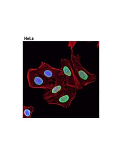 Cell Signaling Dylight 594 Phalloidin