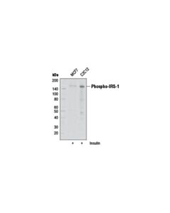 Cell Signaling Irs-1 Inhibition Antibody Sampler Kit