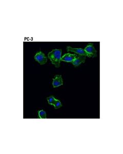Cell Signaling Merlin (D3s3w) Rabbit mAb