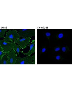 Cell Signaling Epha2 (8b6) Mouse mAb