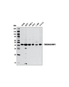 Cell Signaling Tmem49/Vmp1 (D1y3e) Rabbit mAb