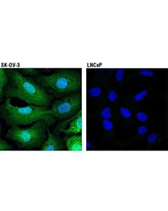 Cell Signaling Galectin-1/Lgals1 (D608t) Rabbit mAb