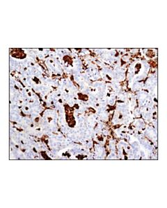 Cell Signaling Gelsolin (D9w8y) Rabbit mAb