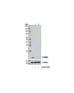 Cell Signaling Signalsilence S100a4 Sirna I
