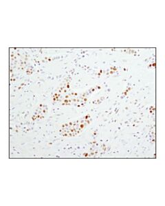 Cell Signaling Mcm4 (D3h6n) Xp Rabbit mAb