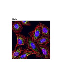 Cell Signaling Catalase (D4p7b) Xp Rabbit mAb