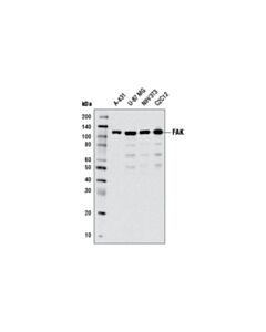 Cell Signaling FAK (D2R2E) Rabbit mAb 20 uL