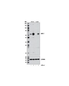 Cell Signaling Irf-7 (D2a1j) Rabbit mAb