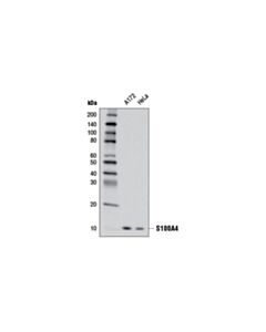 Cell Signaling S100A4 (D9F9D) Rabbit mAb 20 uL