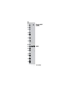 Cell Signaling Phospho-Cdcp1 (Tyr806) Antibody