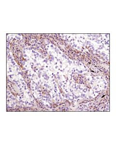 Cell Signaling Lkb1 (D60c5f10) Rabbit mAb (Ihc Formulated)