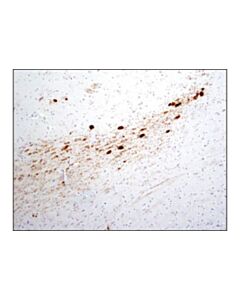 Cell Signaling Phospho-Tyrosine Hydroxylase (Ser31) (D6i9v) Rabbit mAb
