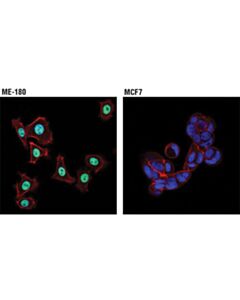 Cell Signaling P63-Alpha (D2k8x) Xp Rabbit mAb
