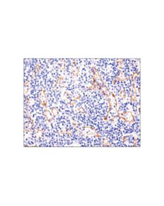 Cell Signaling N-Cadherin (D4r1h) Xp Rabbit mAb