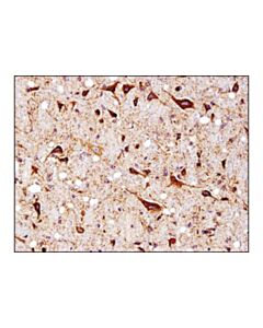 Cell Signaling Sod2 (D3x8f) Xp Rabbit mAb