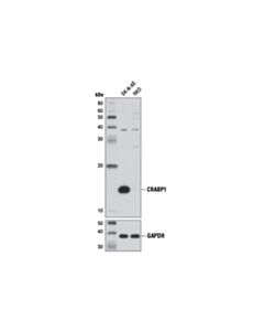 Cell Signaling CRABP1 (D7F9T) Rabbit mAb 20 uL