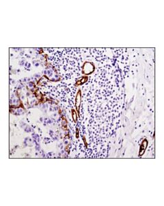 Cell Signaling Integrin Beta3 (D7x3p) Xp<LT/>Sup&Gt;®<LT/>/Sup&Gt; Rabbit mAb