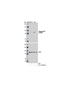 Cell Signaling Phospho-Git2 (Tyr592) (D6l1j) Rabbit mAb
