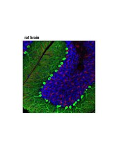 Cell Signaling Calbindin (D1i4q) Xp Rabbit mAb