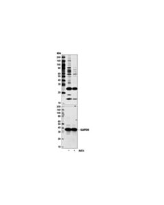 Cell Signaling Symmetric Di-Methyl Arginine Motif [Sdme-Rg] Multimab Rabbit mAb Mix