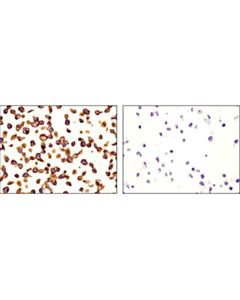 Cell Signaling Cd46 (D6n7h) Rabbit mAb