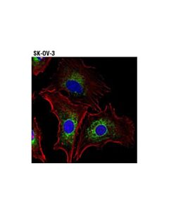 Cell Signaling Kinectin 1 (D5f7j) Rabbit mAb