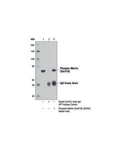 Cell Signaling Phospho-Merlin (Ser518) (D5a4i) Rabbit mAb
