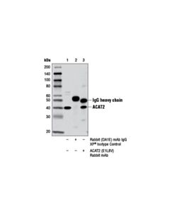 Cell Signaling Acat2 (E1l8v) Rabbit mAb