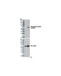 Cell Signaling Phospho-NF-kappaB p65 (Ser536) (E1Z1T) Mouse mAb 20 uL