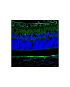 Cell Signaling Clcn3 (D8y5q) Rabbit mAb