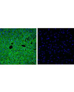 Cell Signaling Fabp1 (D2a3x) Xp Rabbit mAb
